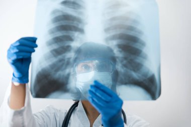 Hastanedeki klinikte bulunan Covid-19 hastasının viral zatürresi için akciğerlerinin röntgenlerini inceleyen bir tıp doktoru. Coronavirus konsepti 