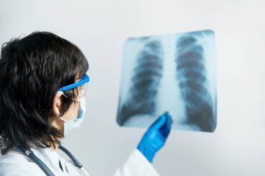 Dotor Scientist göğüs röntgeni filmindeki viral enfeksiyonu ya da zatürree lezyonunu inceliyor. Coronavirus 2019, COVID-19