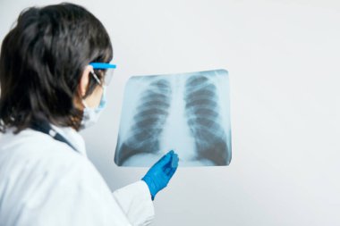 Hastanedeki klinikte bulunan Covid-19 hastasının viral zatürresi için akciğerlerinin röntgenlerini inceleyen bir tıp doktoru. Coronavirus konsepti 