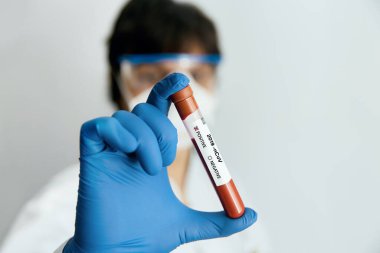 Coronavirus 2019 nCoV kan örneği. Koruyucu eldivenli, maskeli ve gözlüklü bir doktor 2019 nCoV analizi için üzerinde kan olan test tüpü tutuyor. Coronavirus kan testi konsepti. Aşı araştırması