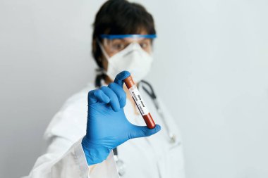 Coronavirus 2019 nCoV kan örneği. Koruyucu eldivenli, maskeli ve gözlüklü bir doktor 2019 nCoV analizi için üzerinde kan olan test tüpü tutuyor. Coronavirus kan testi konsepti. Aşı araştırması