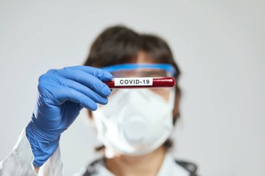 Doktor bilim adamı 2019 nCoV analizi için test tüpünü kanla tutuyor. Roman Coronavirus kan testi konsepti. Aşı araştırması.
