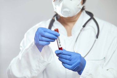 Doktor bilim adamı 2019 nCoV analizi için test tüpünü kanla tutuyor. Roman Coronavirus kan testi konsepti. Aşı araştırması.