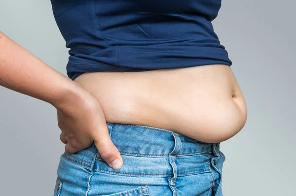 Надмірна вага жінки в джинсах і жирі на стегнах і животі — стокове фото