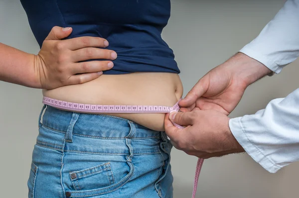 Médico trata uma mulher com excesso de peso — Fotografia de Stock