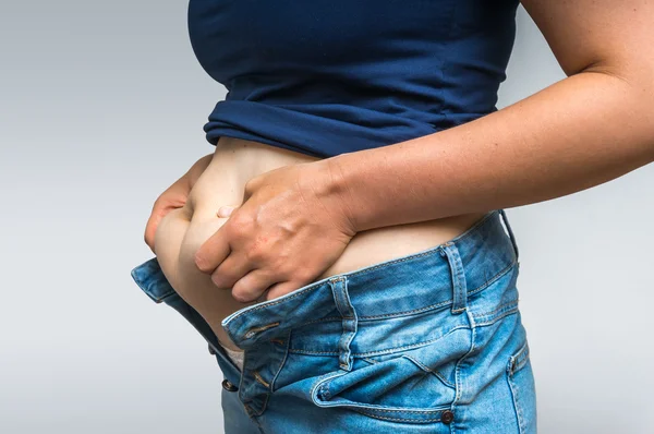 Overweight corpo da mulher com as mãos tocando gordura da barriga — Fotografia de Stock