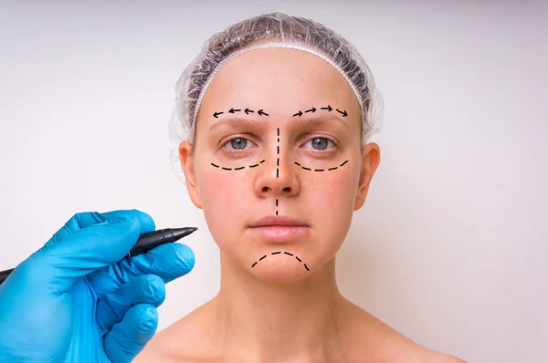 Plastische Chirurgie Arzt zeichnen Linien mit Marker auf Patientengesicht — Stockfoto