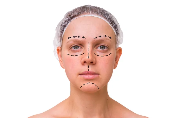 Doctor makes dotted lines on female face for cosmetic face lift — Stock Photo, Image