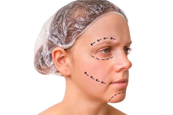 Doctor makes dotted lines on female face for cosmetic face lift — Stock Photo, Image