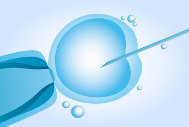 In vitro döllenme (IVF mikroskobik suni tohumlama