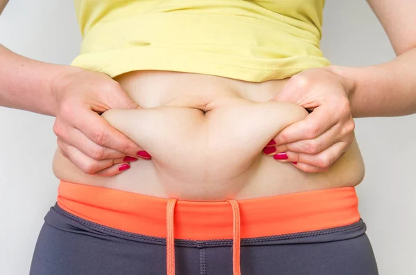 Overweight corpo da mulher com as mãos tocando gordura da barriga — Fotografia de Stock