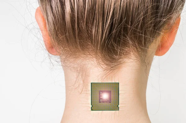 Implant de micropuce bionique dans le corps humain féminin — Photo