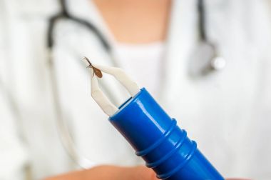 Kadın doktor bir kene cımbızla tutuyor