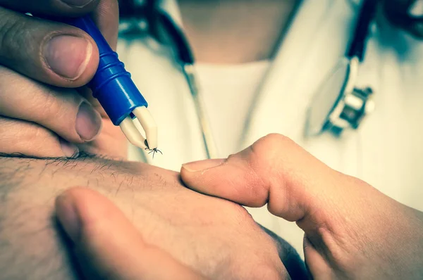 Médico quitando una garrapata con pinzas de la mano del paciente — Foto de Stock