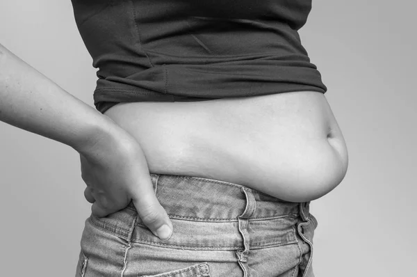 Übergewichtige Frau in Jeans und Fett an Hüfte und Bauch — Stockfoto
