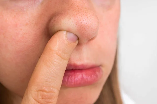 Mulher está colhendo o nariz com o dedo dentro — Fotografia de Stock