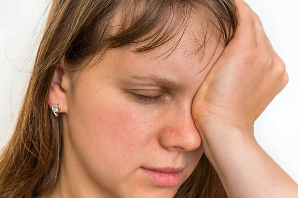 Mujer con ojos dolor está sosteniendo su ojo dolorido — Foto de Stock