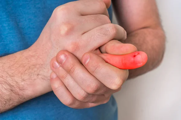 Man with finger pain is holding his aching finger — Stock Photo, Image