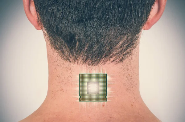Implan chip bionik (prosesor) dalam tubuh manusia — Stok Foto