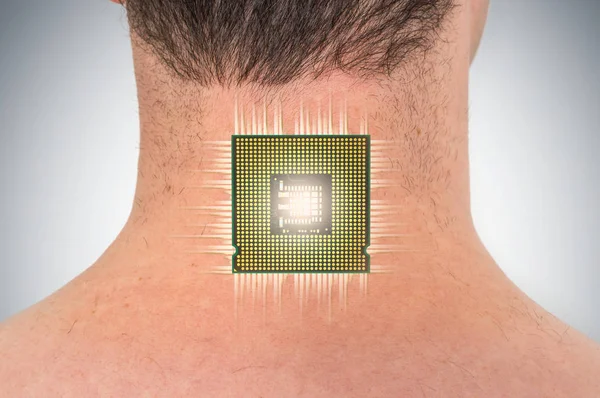 Bionic chip (processor) implant in male human body — Stock Photo, Image