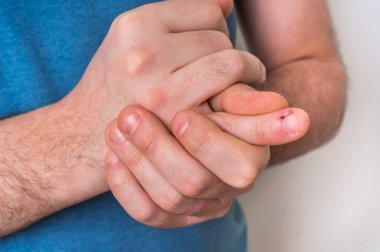 Adam parmak ağrı ile ağrıyan parmağını tutuyor