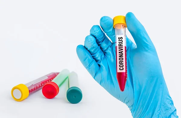 Test-tube with positive blood test on CORONAVIRUS — Stock Photo, Image