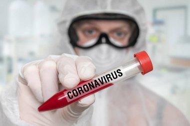 Bilim adamının eli Coronavirus Covid-19 üzerinde pozitif kan testi yapılan bir tüp tutuyor.