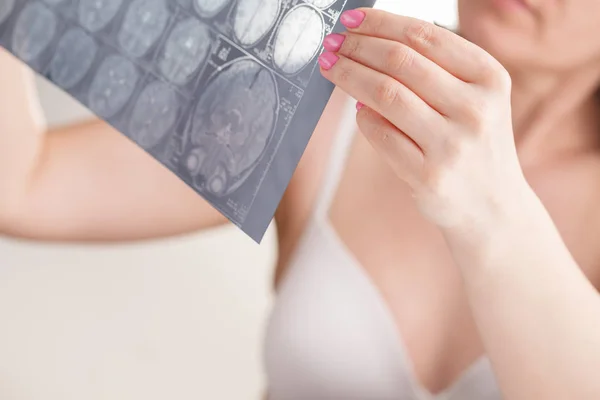 Woman hand holding MRI brain film to see for diagnostic and report. Medical concept — Stock Photo, Image