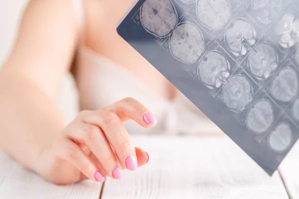 Woman hand holding MRI brain film to see for diagnostic and report. Medical concept — Stock Photo, Image