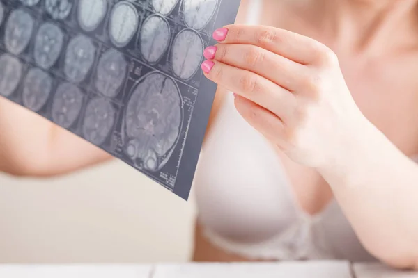 MRI brain scan photo in female hands — Stock Photo, Image