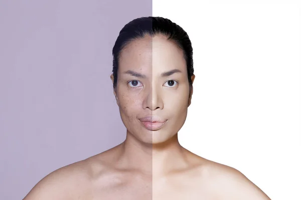 Woman face before and after retouch — Stock Photo, Image