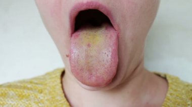 Kız sarı dilini gösterir