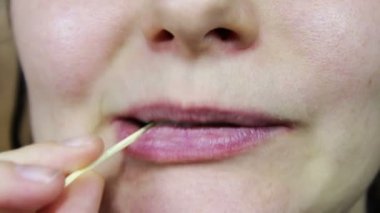 Gıda dişleri kürdan ile almak