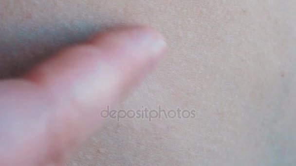 Zbliżenie pieprzyk na skórze człowieka — Wideo stockowe