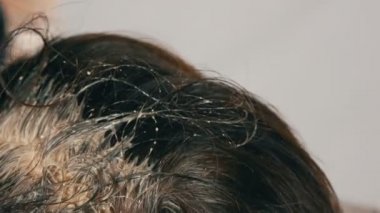 Özel fırça ile saçlarını kendi renklendiren orta yaşlı bir kadının büyümüş gri kökleri. Beyaz bir arka planda bir kadınların kafası koyu saçlı ve beyaz kökleri. Salon yakın görünüm saç bakımı.