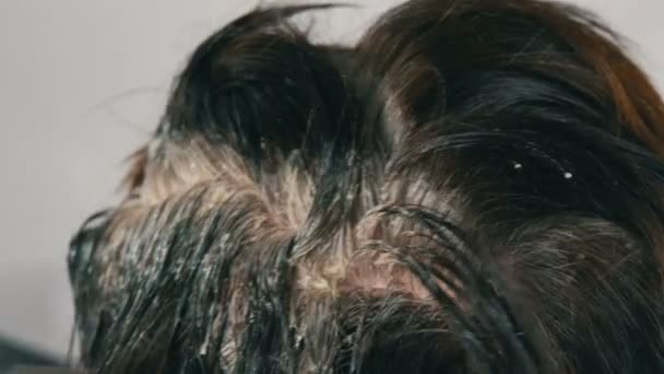 Den övervuxna grå rötter av en medelålders kvinna som avgifter håret själv med speciell borste, ser nära upp. Mörkt hår och vita rötter av en kvinnas huvud på en vit bakgrund. Hår vård närbild — Stockvideo