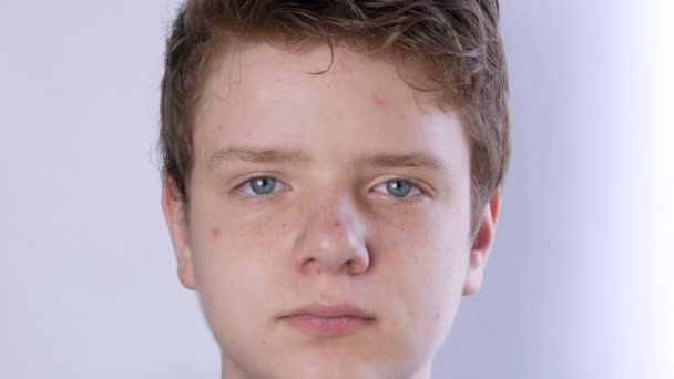 Un jeune garçon mignon avec les cheveux blonds et les yeux bleus avec la peau de problème et l'acné adolescente regarde la caméra sur un fond blanc. Problèmes dermatologiques chez un adolescent. Jeune homme en âge de transition — Video