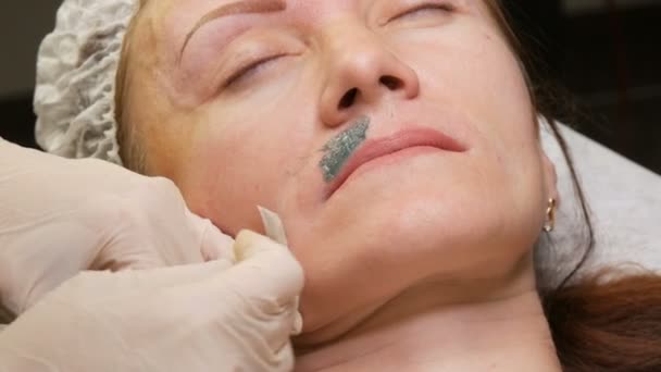 Correction ou épilation. La cire chaude verte est appliquée sur le visage de la femme pour éliminer l'excès de poils dans la zone de moustache — Video