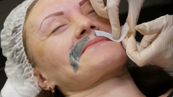 修正またはワックス。口ひげエリアで余分な髪を削除するには、女性の顔に緑の暖かいワックスが適用されます — ストック動画