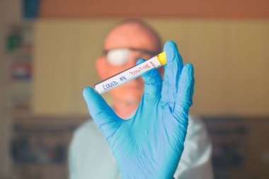 Test tüpündeki Covid 19 örneği. Doktor - epidemiyoloji uzmanı koronavirüs örneğiyle tüpü tutuyor..