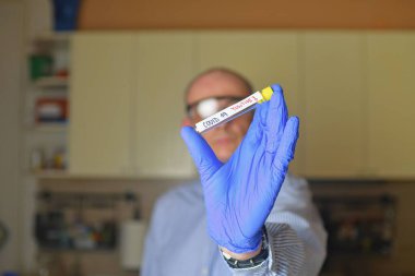 Test tüpündeki Covid 19 örneği. Doktor - epidemiyoloji uzmanı koronavirüs örneğiyle tüpü tutuyor..