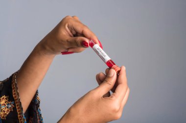 Coronavirüs veya 2019-nCoV analizi için kan örneği içeren bir test tüpü tutan genç kız..