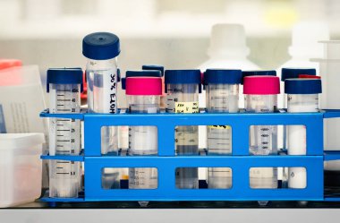 Plastik test tüpleri plastik standı