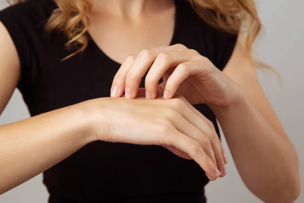 Concepto de enfermedad de la piel. Mujer con las manos picantes . — Foto de Stock