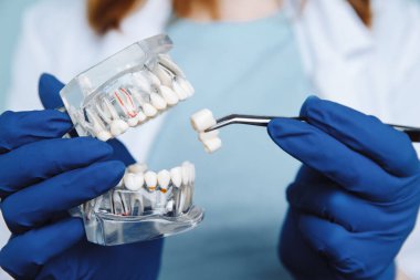 Diş hekimi randevusu, diş hekimliği aletleri ve diş hijyenisti kontrol konsepti. Diş modelleri takma dişler ve koyu gri üzerine stomatoloji aletleri. Düzenli kontroller oral sağlık için gereklidir