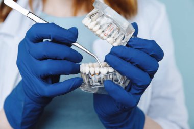 Diş hekimi randevusu, diş hekimliği aletleri ve diş hijyenisti kontrol konsepti. Diş modelleri takma dişler ve koyu gri üzerine stomatoloji aletleri. Düzenli kontroller oral sağlık için gereklidir