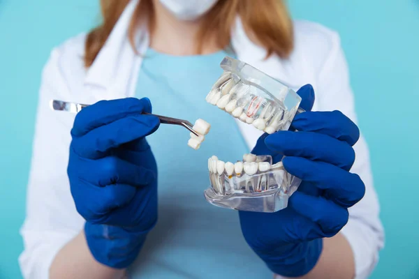 Consulta odontológica, instrumentos odontológicos e conceito de check-up higienista dentário com dentaduras modelo e instrumentos de estomatologia em cinza escuro. Verificações regulares são essenciais para a saúde bucal — Fotografia de Stock