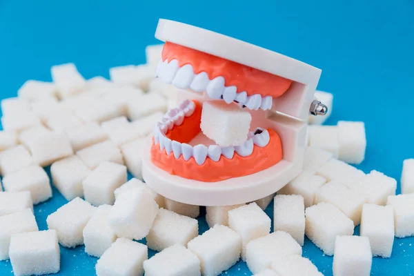 A peace of sugar in the fake jaw with a lot of holes in teeth isolated. — Stock Photo, Image