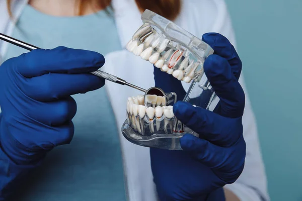 Consulta odontológica, instrumentos odontológicos e conceito de check-up higienista dentário com dentaduras modelo e instrumentos de estomatologia em cinza escuro. Verificações regulares são essenciais para a saúde bucal — Fotografia de Stock