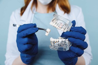 Diş hekimi randevusu, diş hekimliği aletleri ve diş hijyenisti kontrol konsepti. Diş modelleri takma dişler ve koyu gri üzerine stomatoloji aletleri. Düzenli kontroller oral sağlık için gereklidir